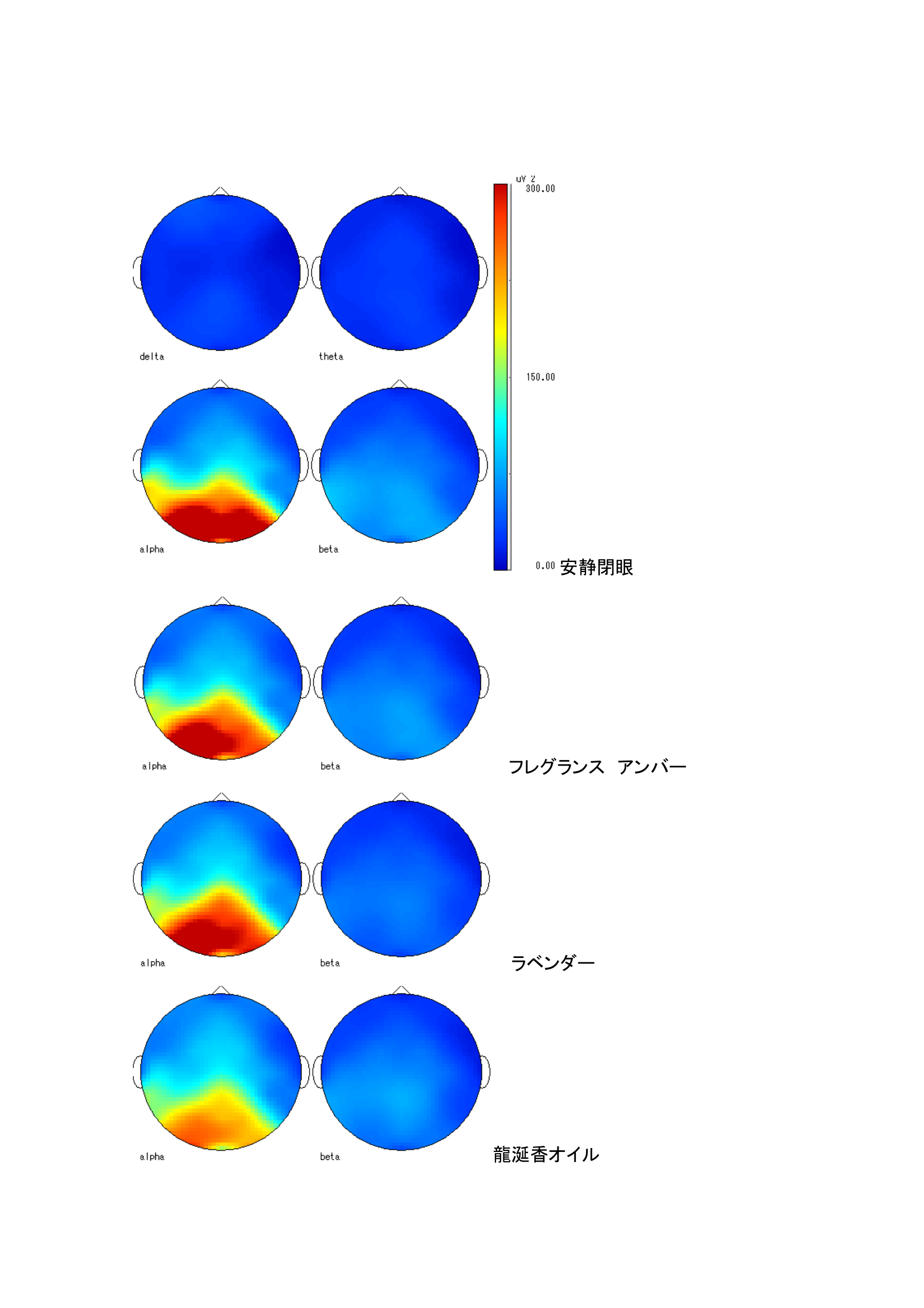 トポグラフ：各条件での脳波マップ（被験者A）