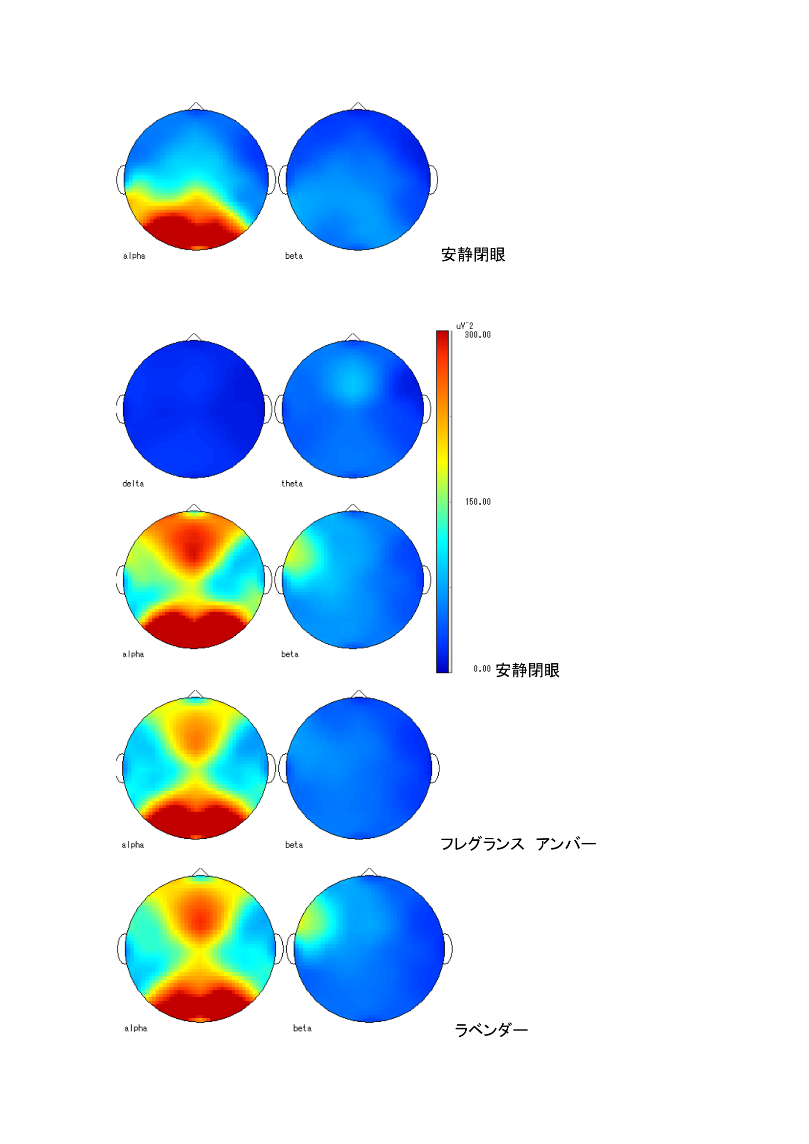 トポグラフ：各条件での脳波マップ（被験者B）