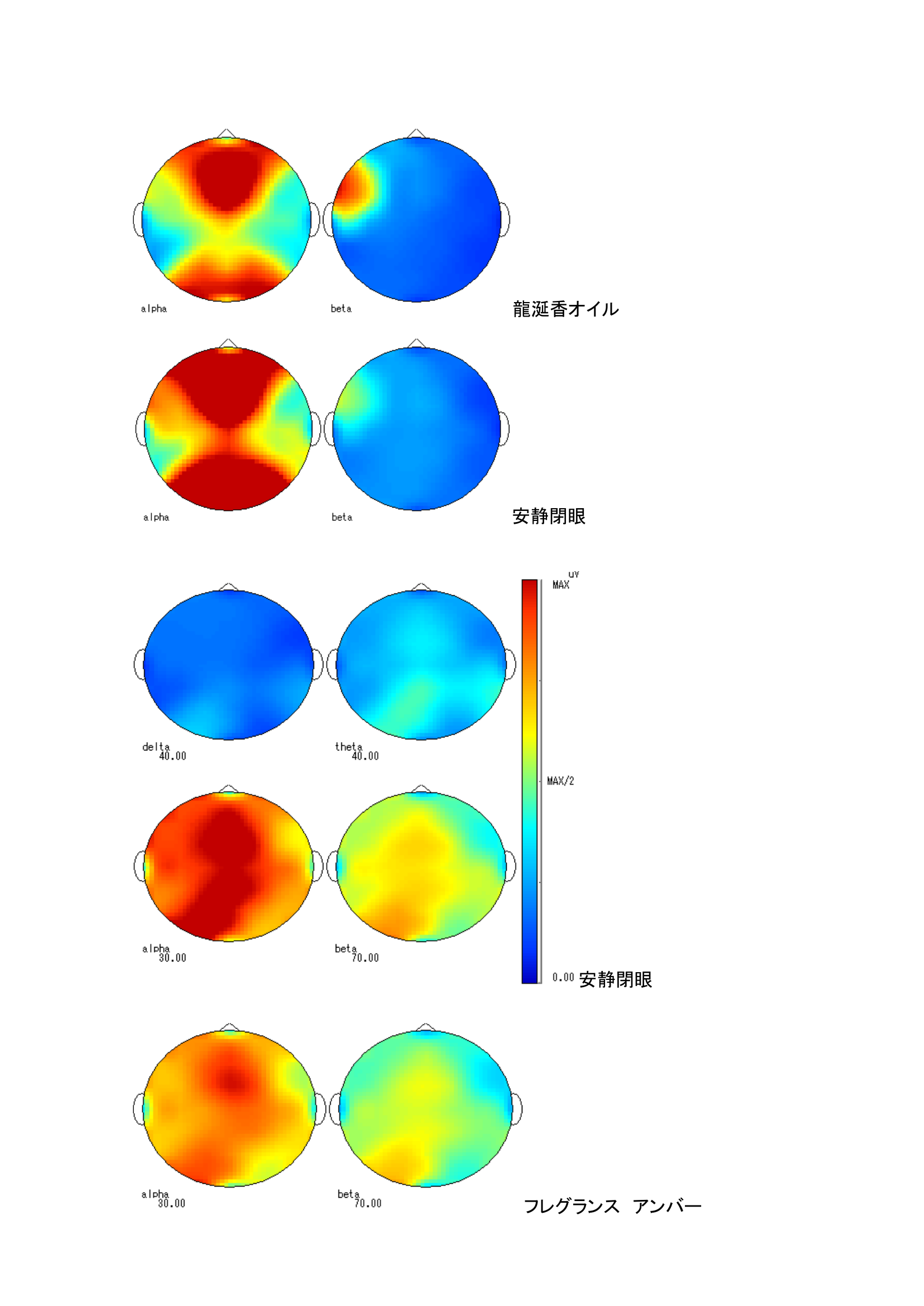 トポグラフ：各条件での脳波マップ（被験者C）