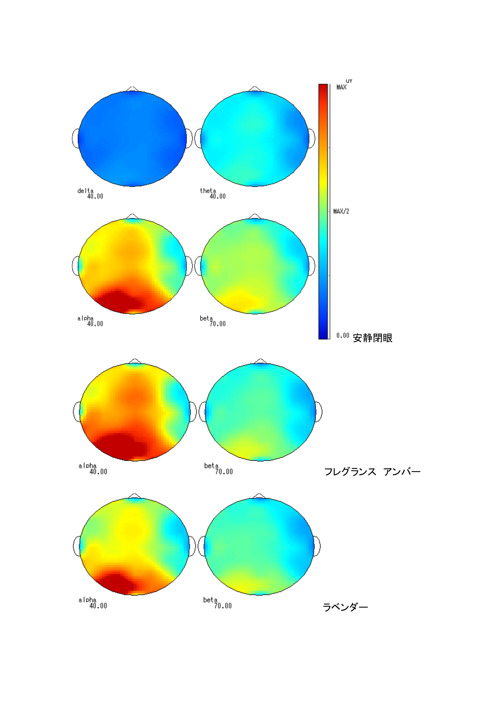 トポグラフ：各条件での脳波マップ（被験者D）